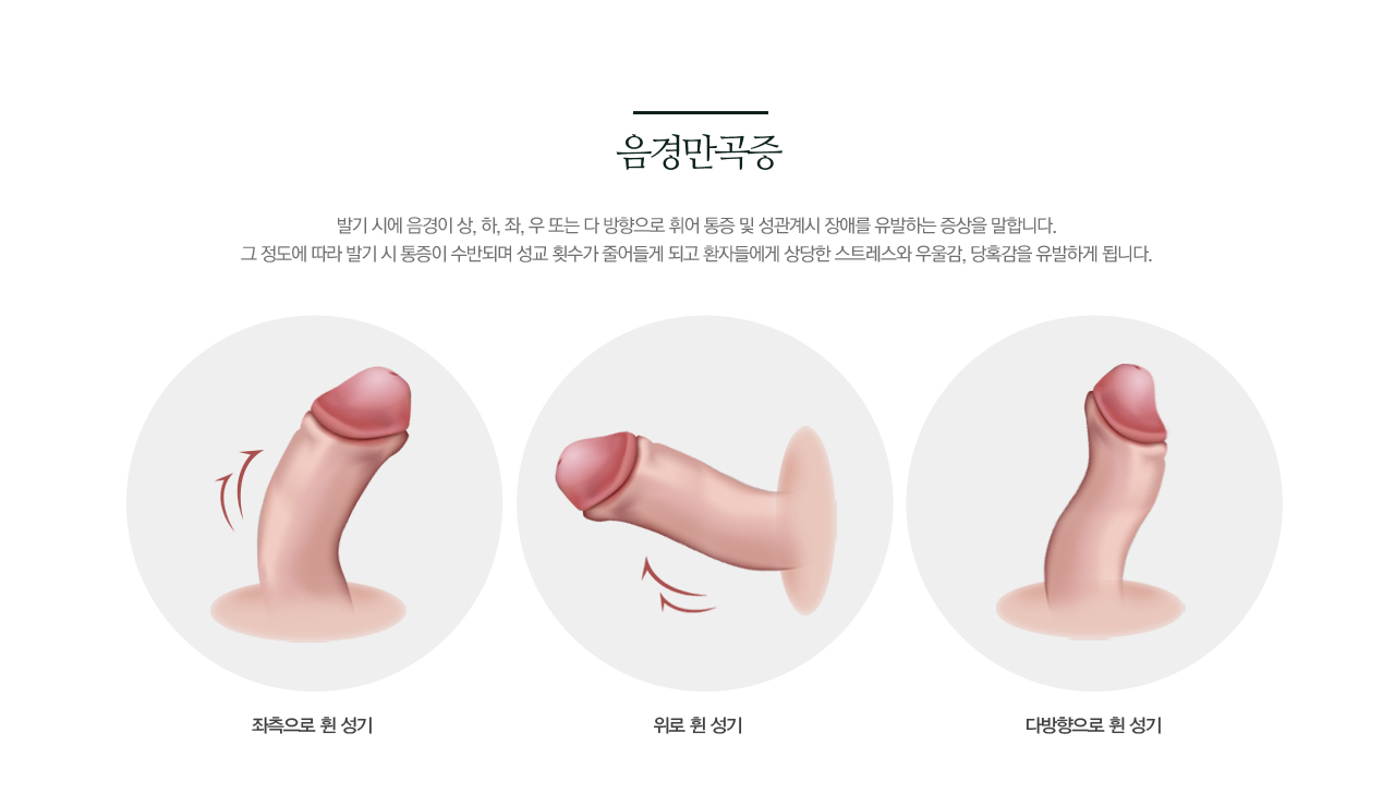 만곡증