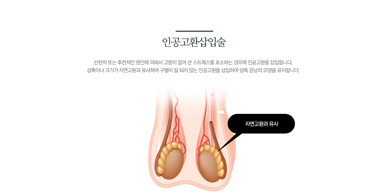 인공고환삽입술